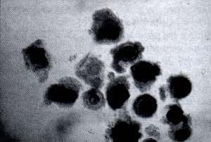 Diferentes Tipos de Oocitos Diferentes Tipos de Oocitos