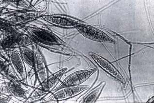 Microsporum canis Microsporum canis