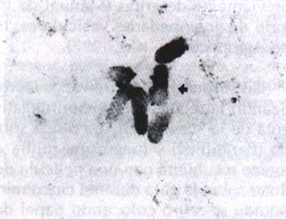 Partículas virales en medio extracelular del cultivo de células vero Partículas virales en medio extracelular del cultivo de células vero