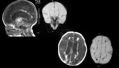 Resonancia magnética nuclear