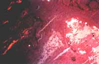 Piel. Birrefringencia de cristales en las áreas correspondientes al material amorfo  Piel. Birrefringencia de cristales en las áreas correspondientes al material amorfo