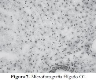 Microfotografía Hígado Microfotografía Hígado
