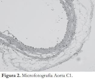 Microfotografia Aorta Microfotografia Aorta