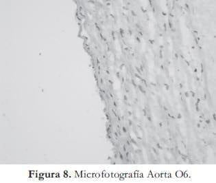 Microfotografía Aorta Microfotografía Aorta
