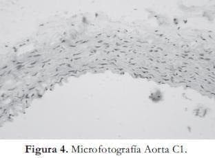 Microfotografia Aorta Microfotografia Aorta