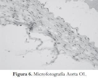 Microfotografía Aorta Microfotografía Aorta