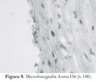 Microfotografía Aorta Microfotografía Aorta