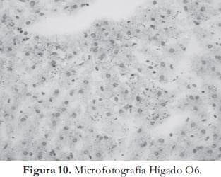 Microfotografía Hígado Microfotografía Hígado
