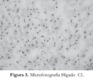 Microfotografia Hígado Microfotografia Hígado