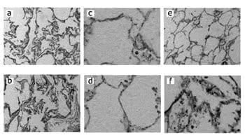 Pulmón de adulto joven Pulmón de adulto joven