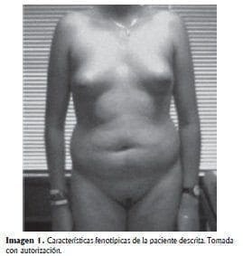 Fenotipicas infertilidad primaria