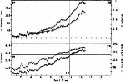 La curva de VCO2 (Cuadros) y VE (+) La curva de VCO2 (Cuadros) y VE (+)
