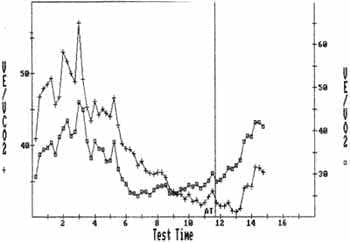 Relación entre la VE y la VCO2 y el VO2 Relación entre la VE y la VCO2 y el VO2