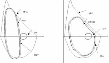 Ventilación voluntaria máxima en el panel izquierdo Ventilación voluntaria máxima en el panel izquierdo
