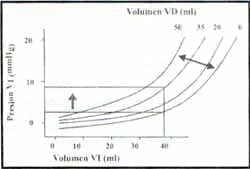  El diagrama del ventrículo derecho