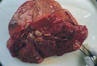 Imagen macroscópica de las lesiones ganglionares hiliares Imagen macroscópica de las lesiones ganglionares hiliares