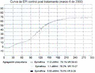 Curva de EPI control post tratamiento