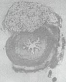 Imagen de los implantes de macroplástico Imagen de los implantes de macroplástico