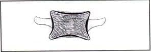 Corte coronal de vértebra con esquematización de trabéculas. Corte coronal de vértebra con esquematización de trabéculas.