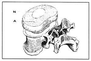 Disco intervertebral. Disco intervertebral.
