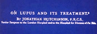 Facsímil del artículo de Jonathan Hutchinson, sobre lupus y su tratamiento Facsímil del artículo de Jonathan Hutchinson, sobre lupus y su tratamiento