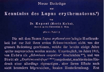 Facsímil del artículo de Kaposi publicado en 1872 Facsímil del artículo de Kaposi publicado en 1872