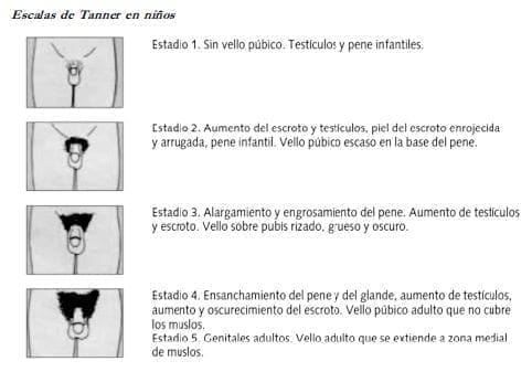 Escalas de Tanner en niños