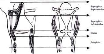 Vaciamiento cervical Vaciamiento cervical