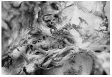 Seno Cavernoso derecho