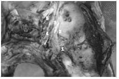 Triángulos paraselares