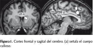 Cortes frontal y sagital del cerebro