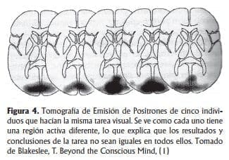 Tomografía emisión de positrones
