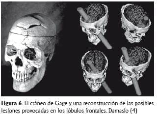 El craneo de Gage