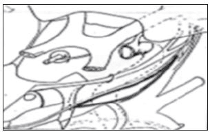 Triàngulo lateral o de parkinson