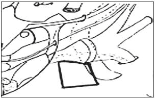 Triangulo postero medial o de kawase