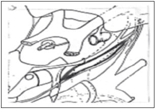 Triàngulo superior o paramediano