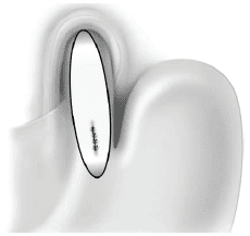 Reparación de la mucosa