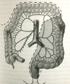 Límites para la resección anterior baja de recto