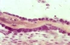 Osteoblastos de forma poliédrica