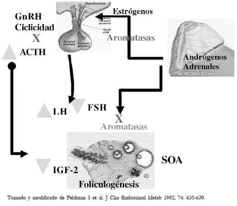 Síndrome de ovario poliquístico Síndrome de ovario poliquístico