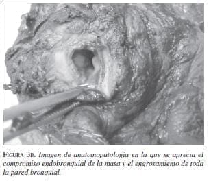 Imagen de Anatomopatología Imagen de Anatomopatología