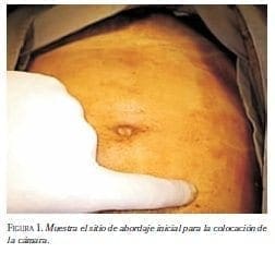 Muestra el Sitio de Abordaje Inicial