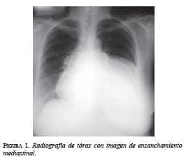 Radiografía de tórax