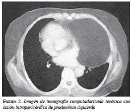 Imagen de Tomografía
