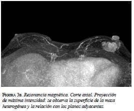 Resonancia magnética corte axial Resonancia magnética corte axial