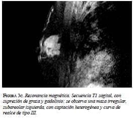 Resonancia magnéticasecuencia sagital Resonancia magnéticasecuencia sagital