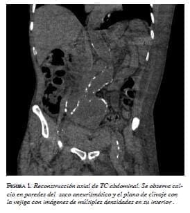Reconstrucción axial de TC abdominal