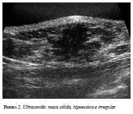 Ultrasonido masa sólida Ultrasonido masa sólida