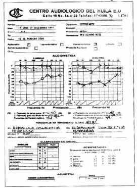Audiometría tonal preoperatoria