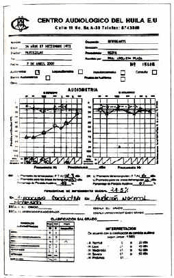 Audiometría tonal un mes postoperatorio